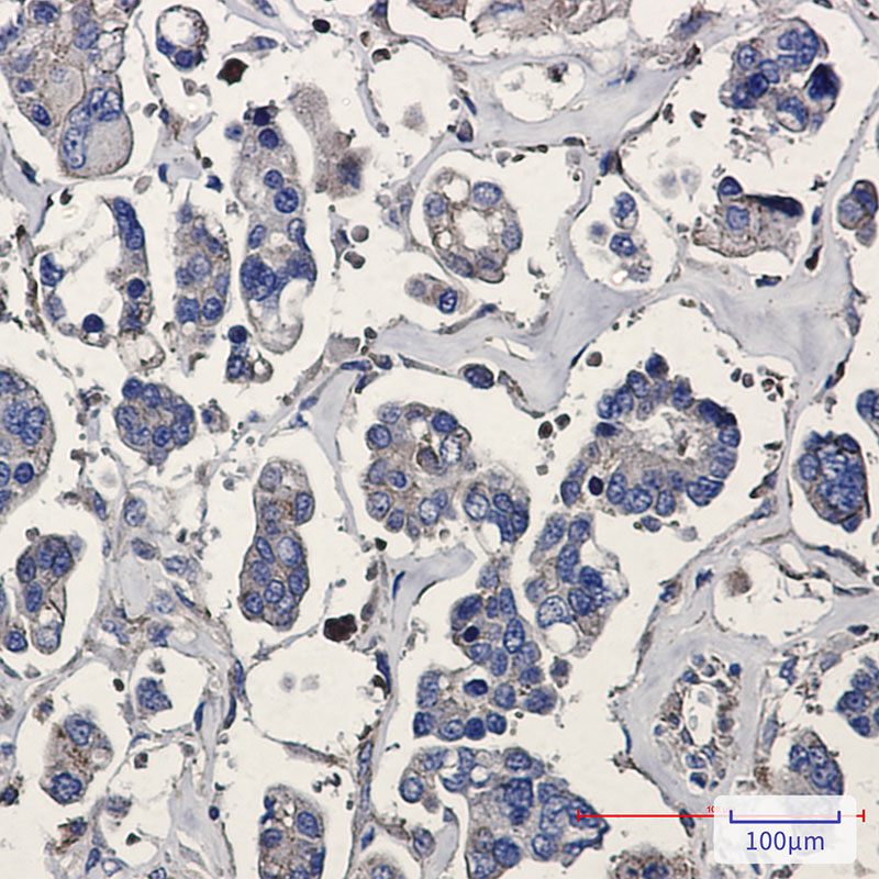 Rabbit Monoclonal Antibody to p16 ARC
