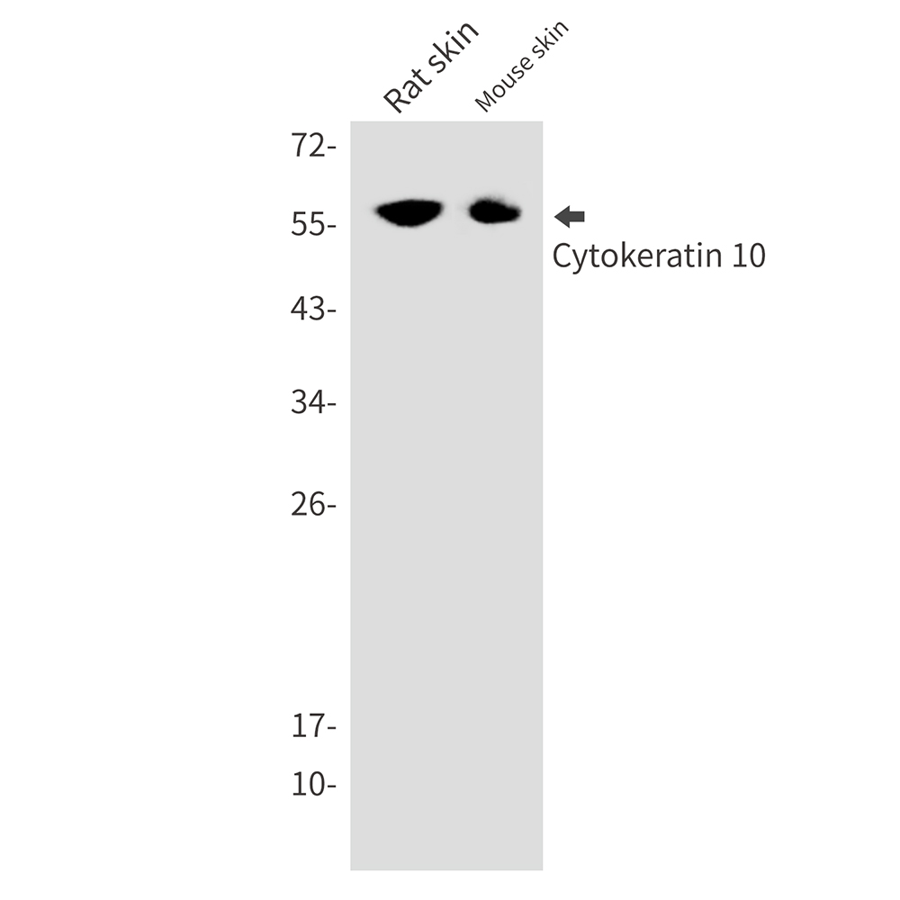 Cytokeratin 10