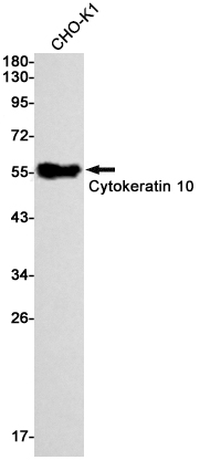 Rabbit Monoclonal Antibody to Cytokeratin 10