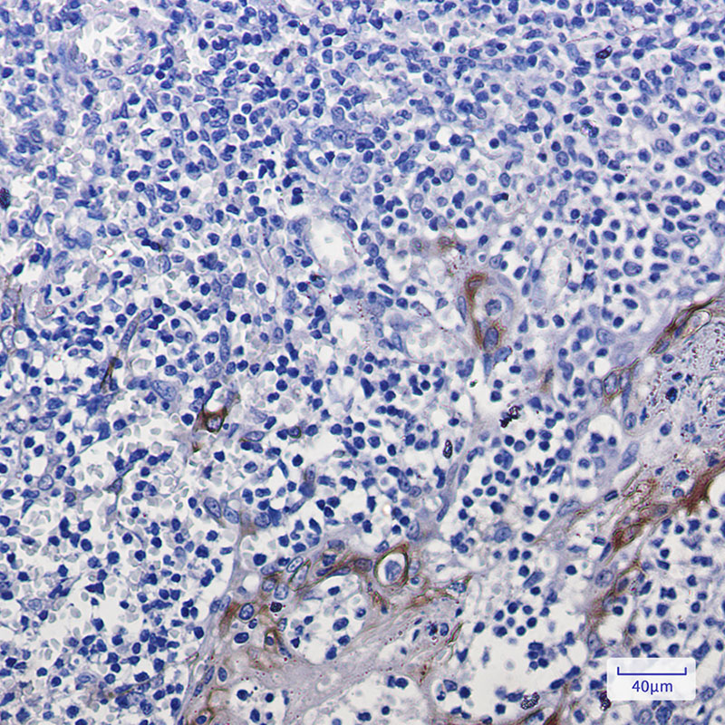 Rabbit Monoclonal Antibody to Cytokeratin 10