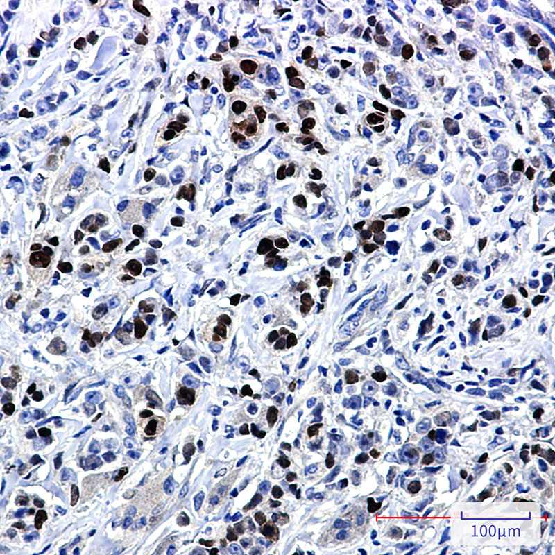 Rabbit Monoclonal Antibody to SOX9