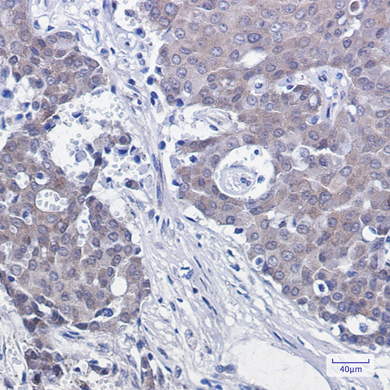 Rabbit Monoclonal Antibody to NEDD8