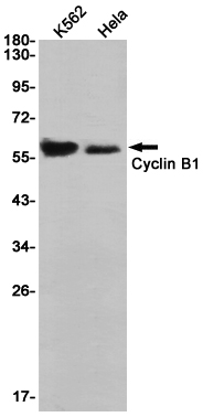 Rabbit Monoclonal Antibody to Cyclin B1