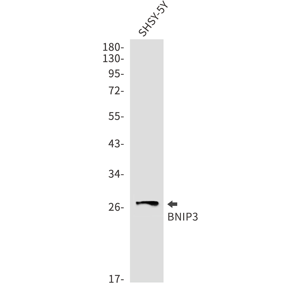 BNIP3