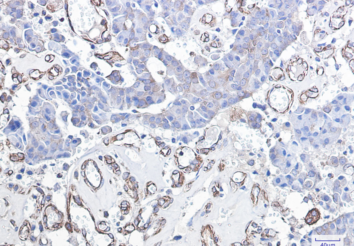 Rabbit Monoclonal Antibody to DDIT3