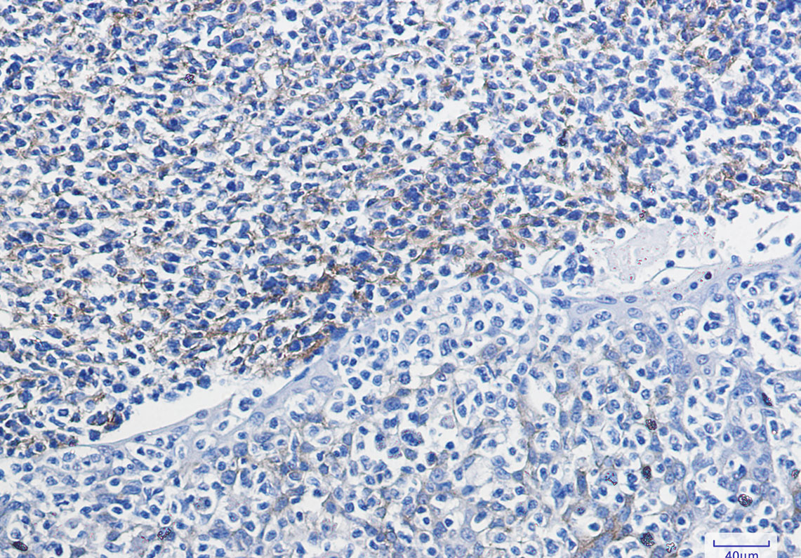Rabbit Monoclonal Antibody to VCAM1