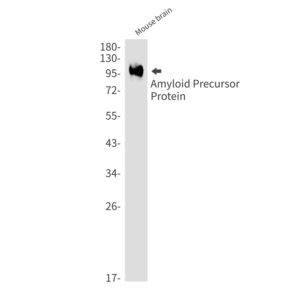 Amyloid Precursor Protein
