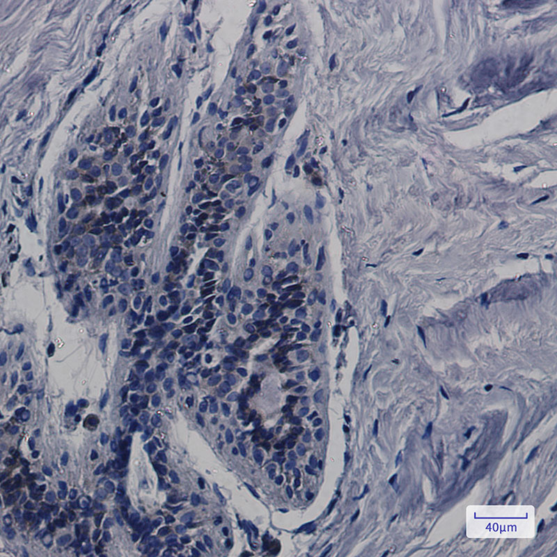 Rabbit Monoclonal Antibody to CDK5RAP3