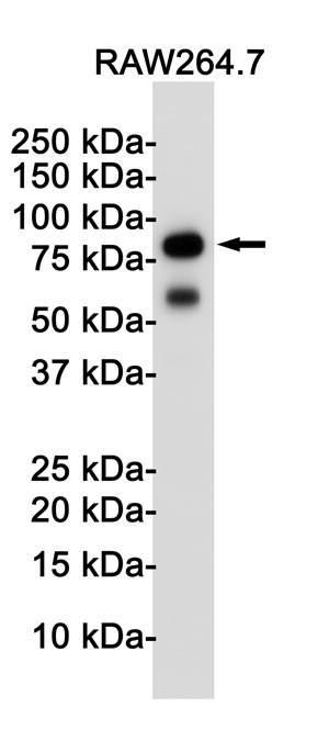 Toll-Like Receptor 2