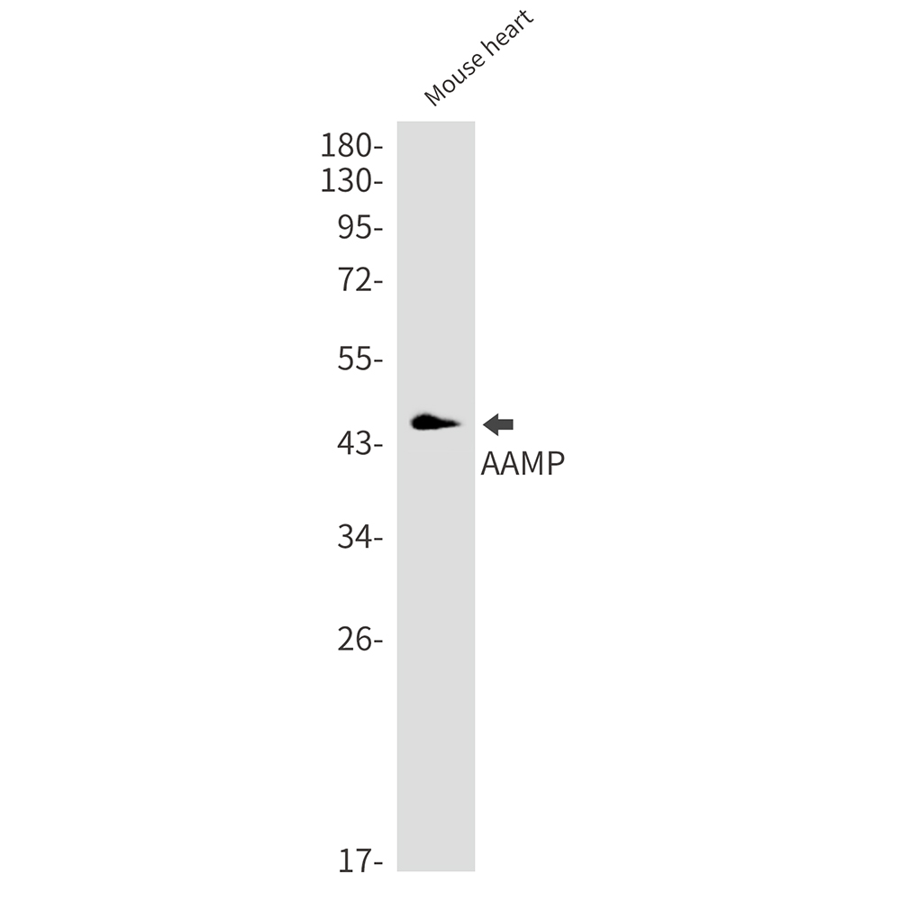 AAMP