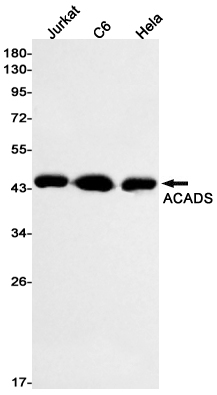 Rabbit Monoclonal Antibody to ACADS