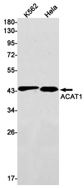 ACAT1