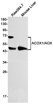 Rabbit Monoclonal Antibody to ACOX1