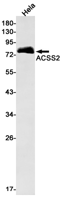 ACSS2