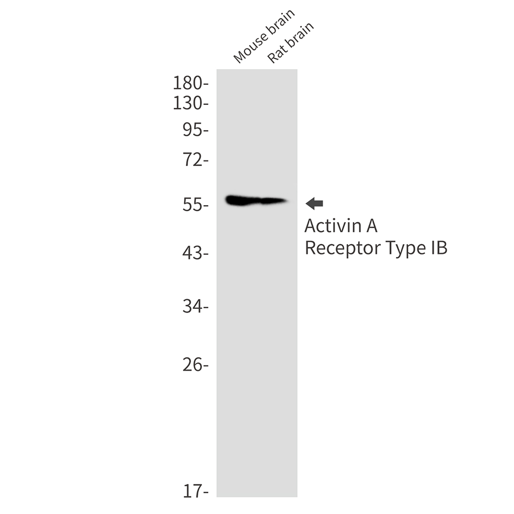 Activin A Receptor Type IB