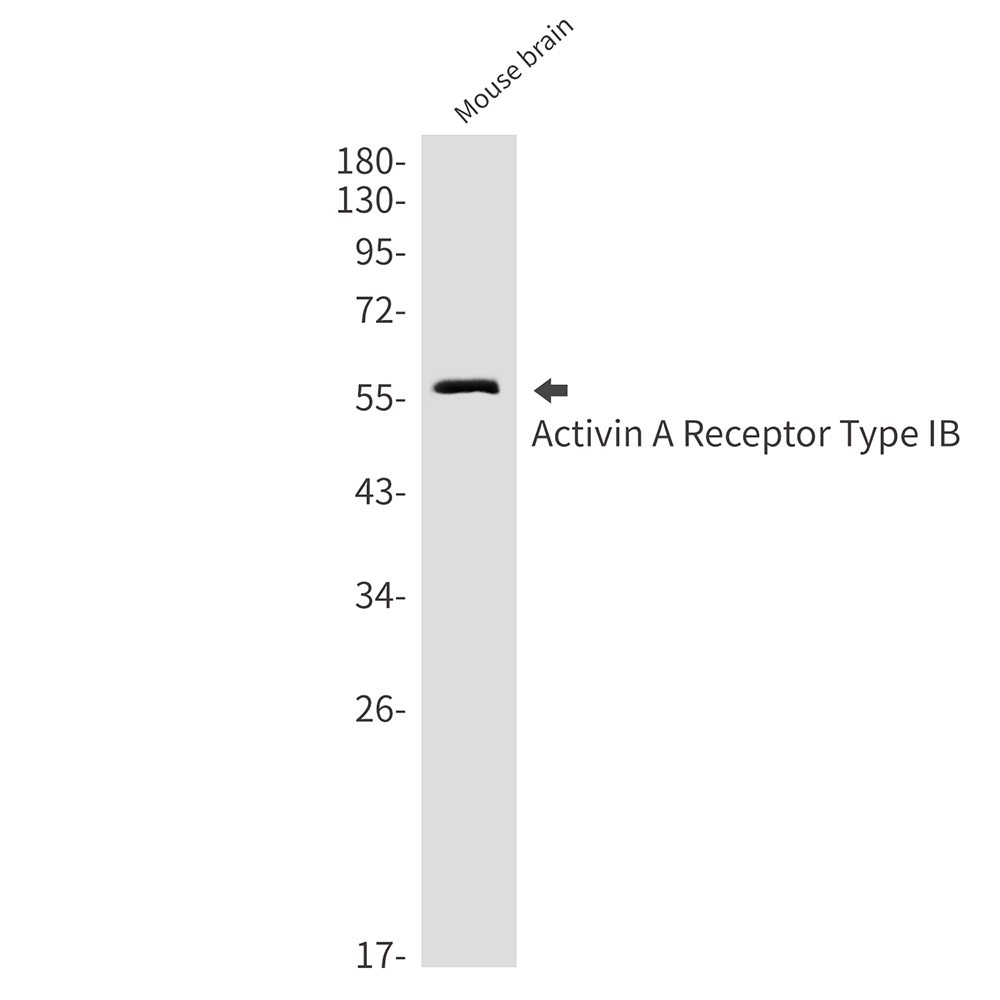 Activin A Receptor Type IB