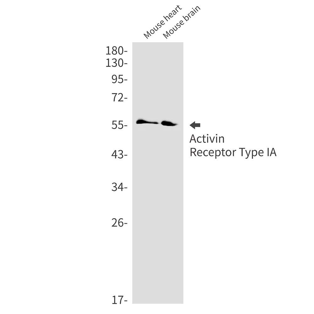 Activin Receptor Type IA