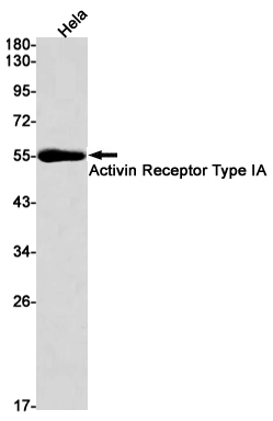 Rabbit Monoclonal Antibody to Activin Receptor Type IA