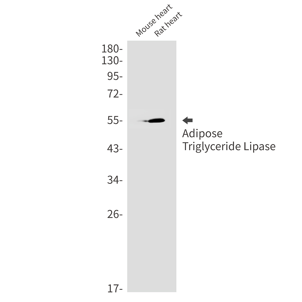 Adipose Triglyceride Lipase