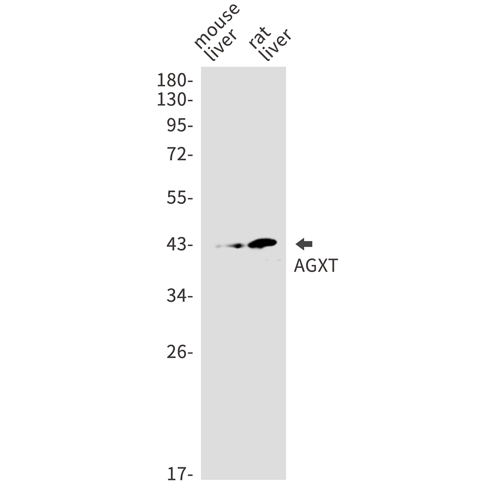 AGXT