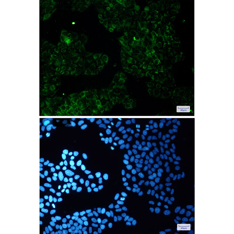 Rabbit Monoclonal Antibody to ALDH7A1