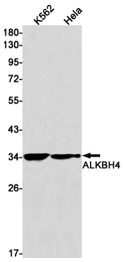 ALKBH4