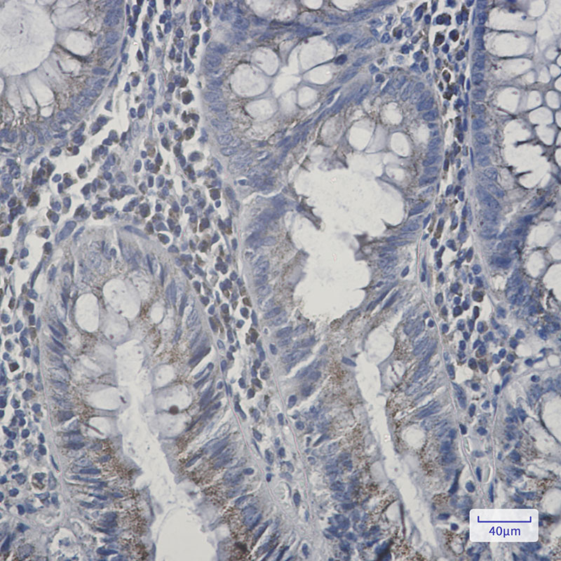 Rabbit Monoclonal Antibody to AGPS
