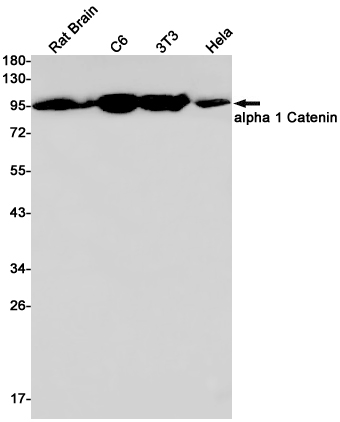 CTNNA1