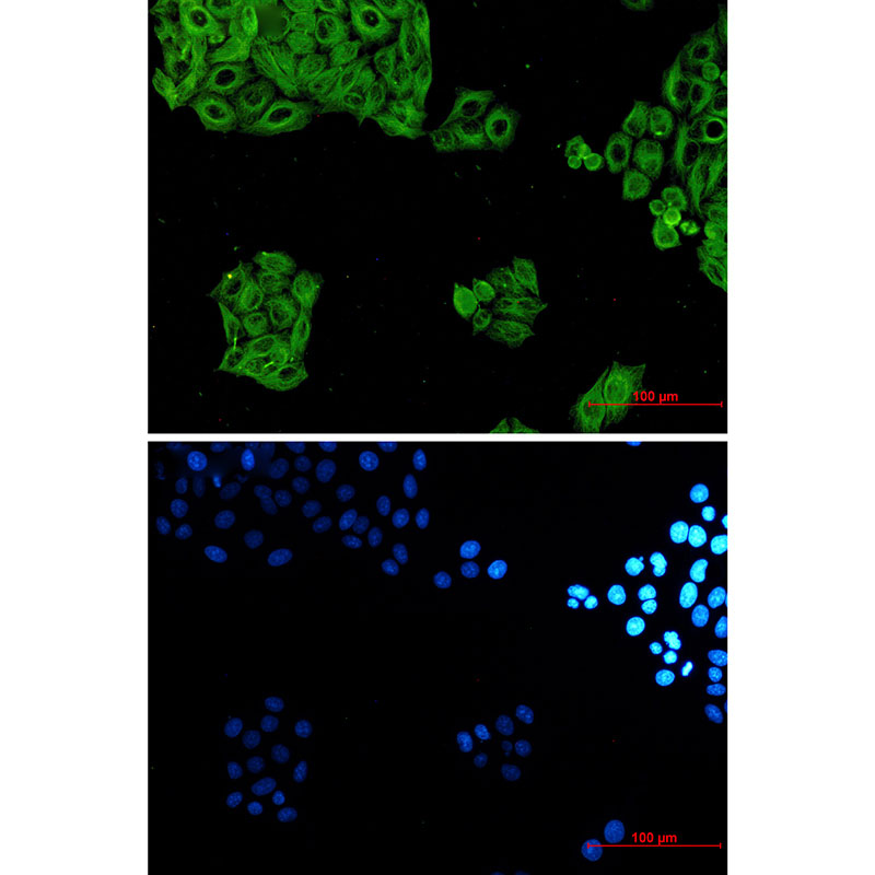 Rabbit Monoclonal Antibody to alpha Tubulin