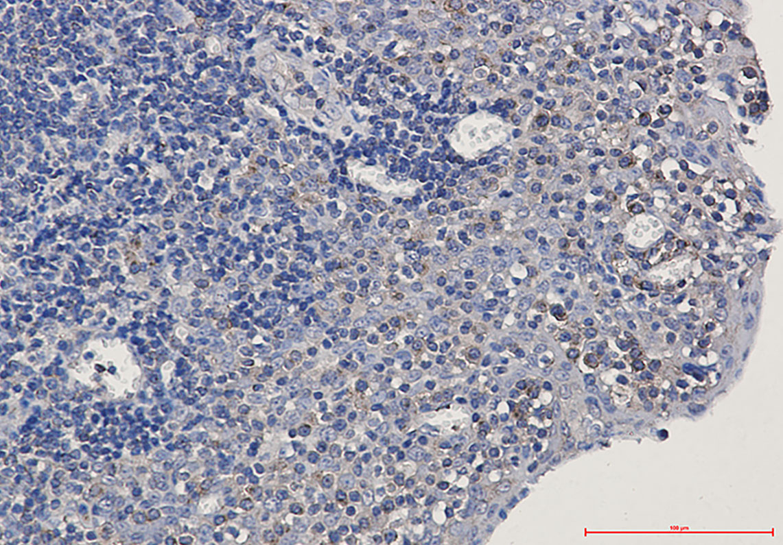 Rabbit Monoclonal Antibody to alpha Tubulin