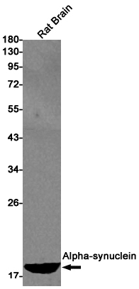alpha Synuclein