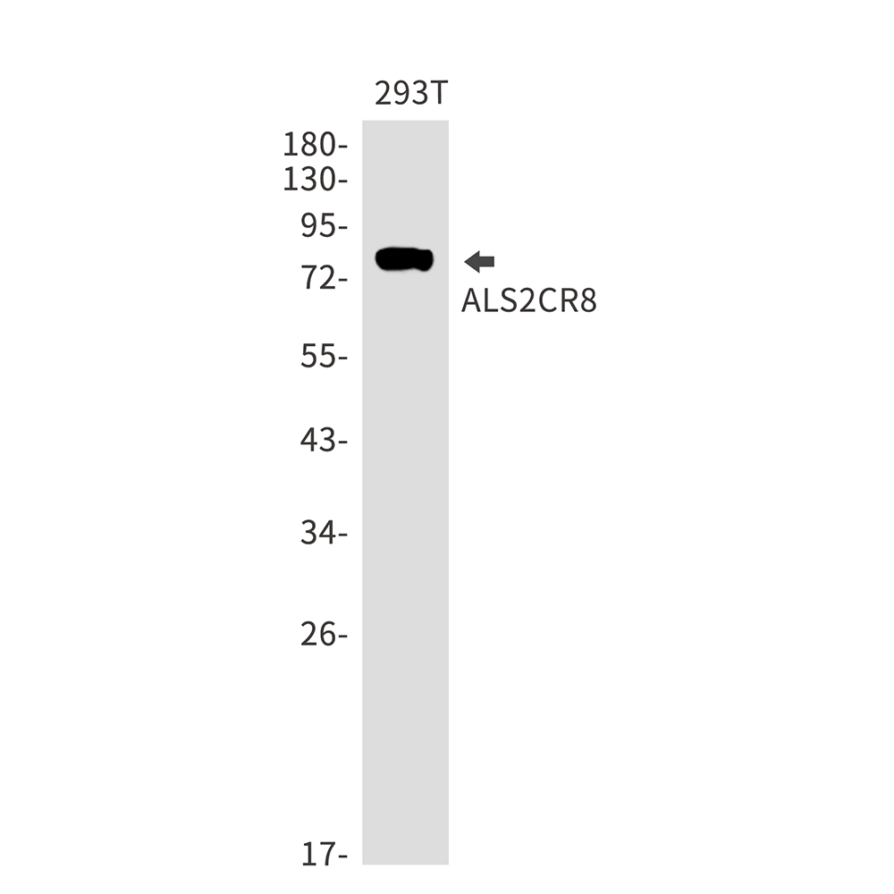ALS2CR8