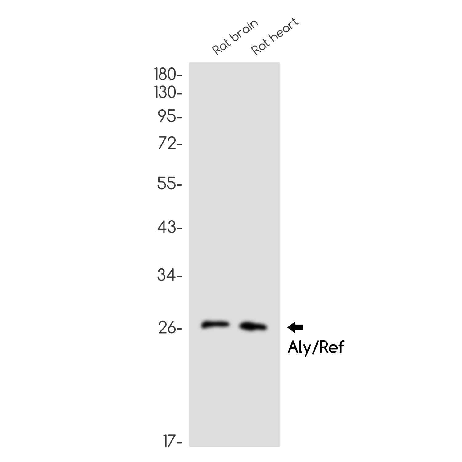 Aly