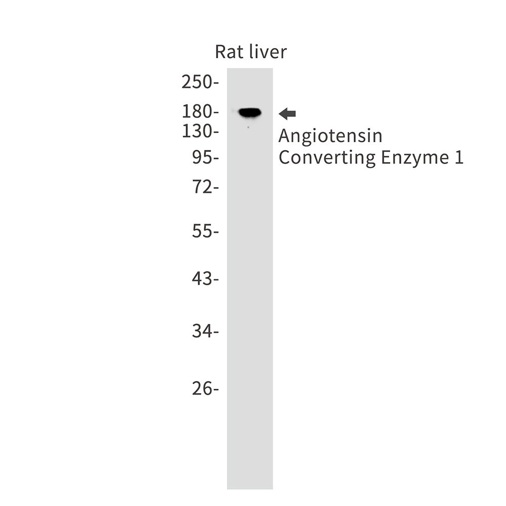 Angiotensin Converting Enzyme 1