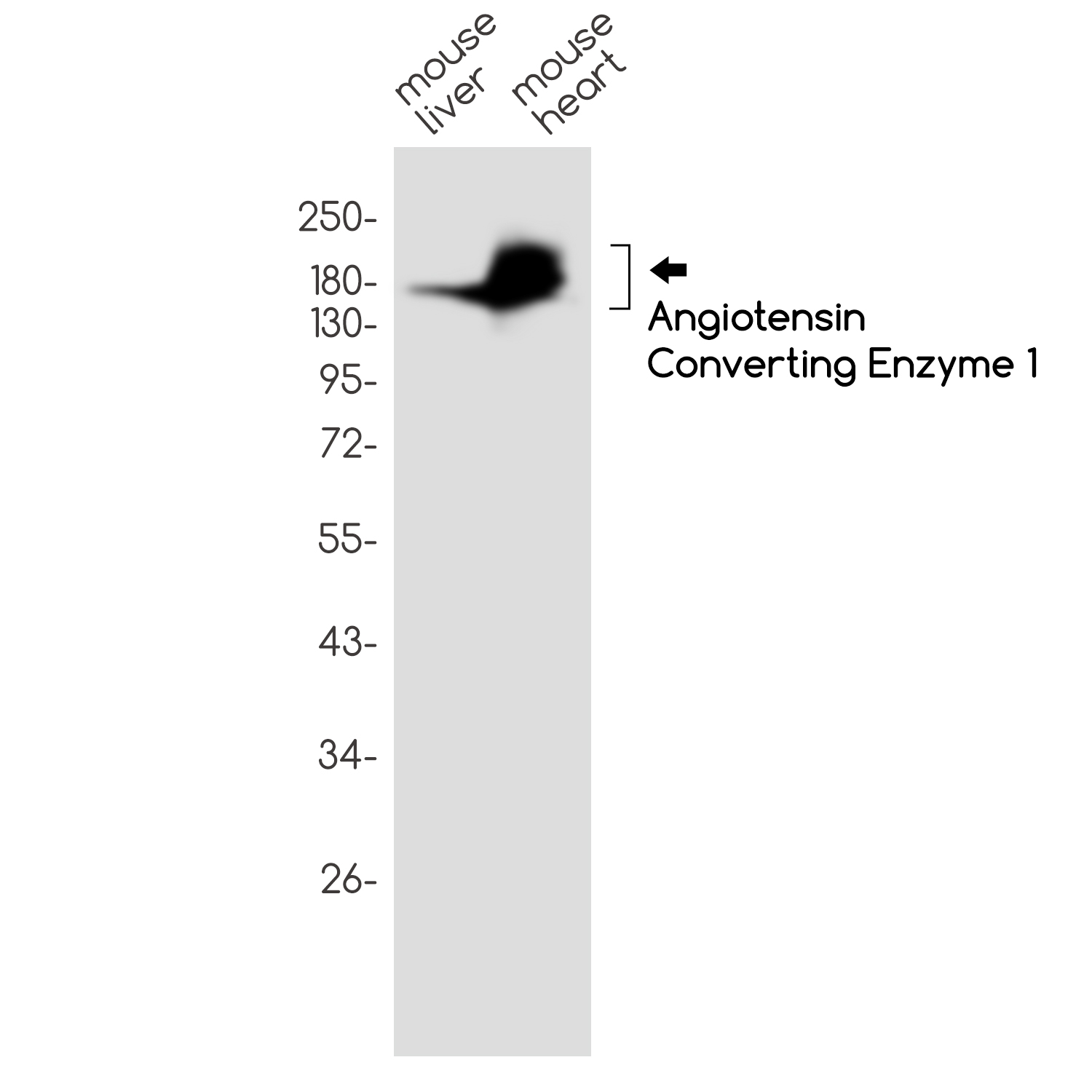 Rabbit Monoclonal Antibody to Angiotensin Converting Enzyme 1