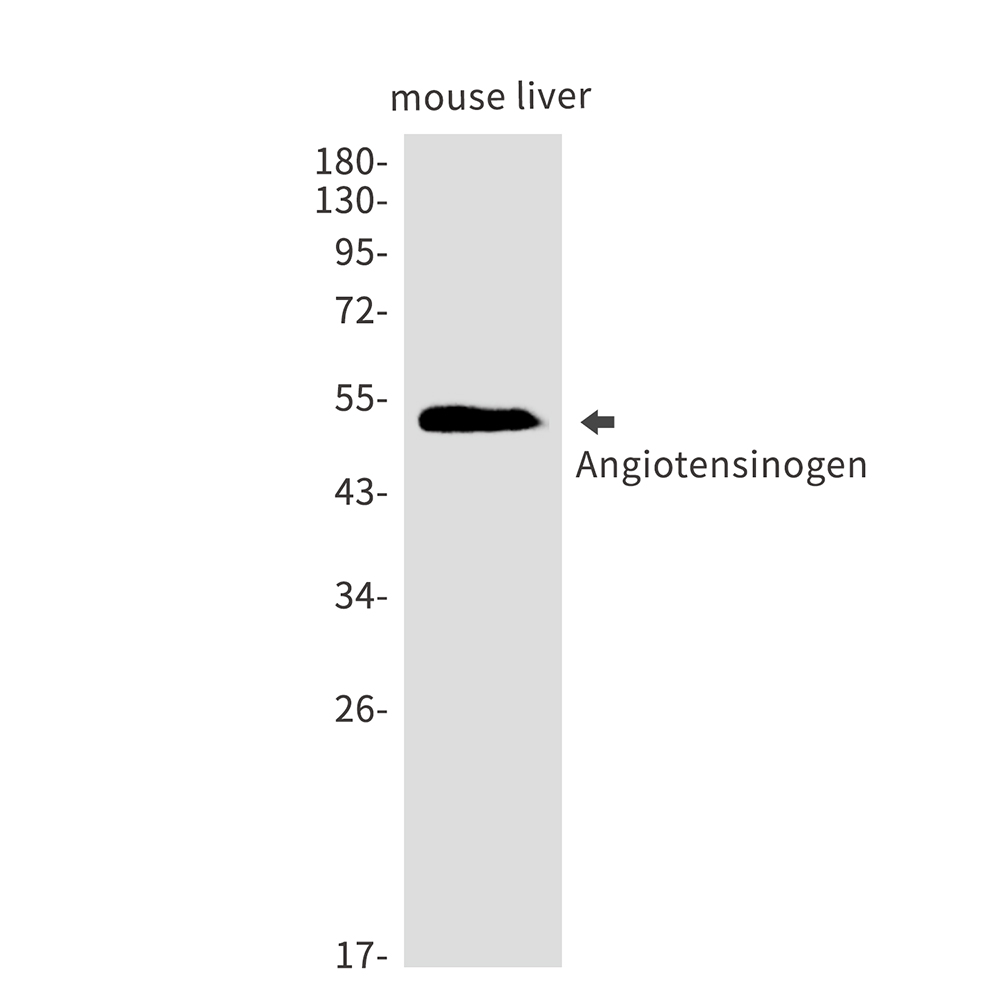 Angiotensinogen