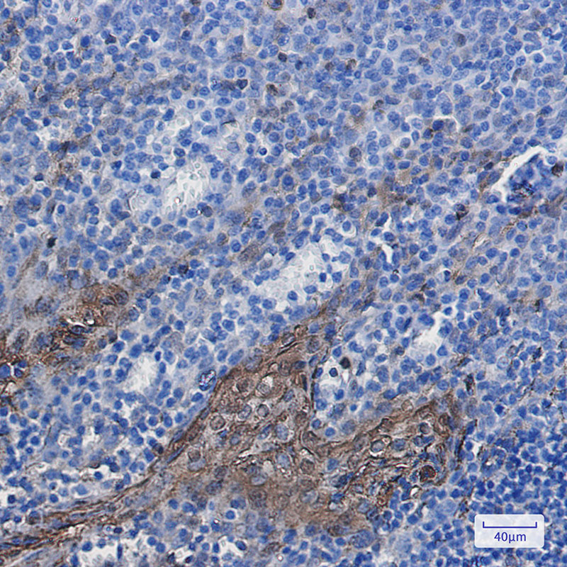 Rabbit Monoclonal Antibody to Annexin A1