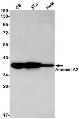 Annexin A2