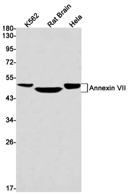Annexin VII
