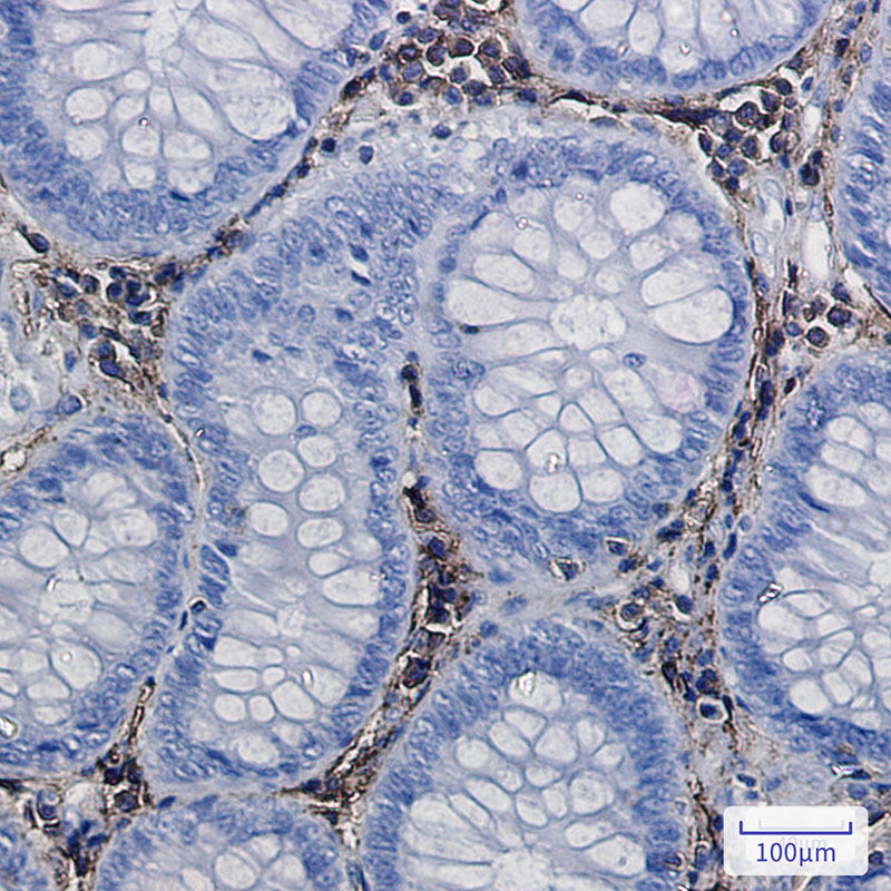Rabbit Monoclonal Antibody to Annexin VI