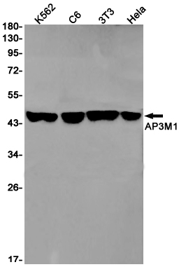 AP3M1
