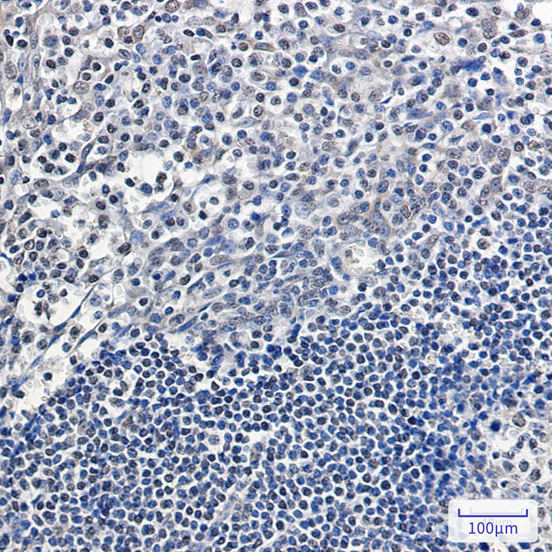 Rabbit Monoclonal Antibody to APE1