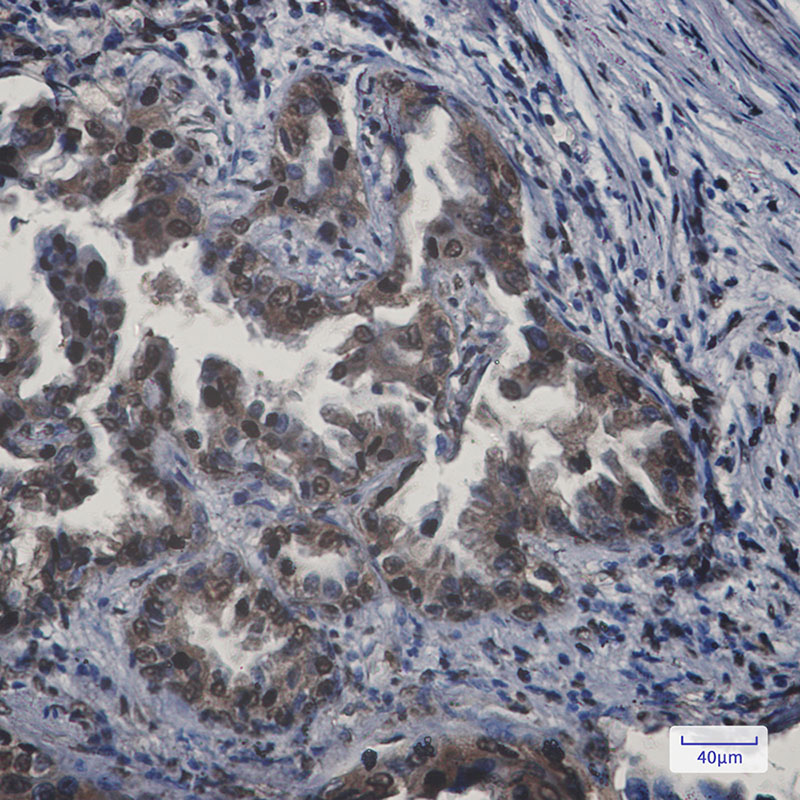 Rabbit Monoclonal Antibody to APPL
