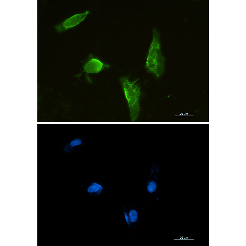 Rabbit Monoclonal Antibody to Aprataxin