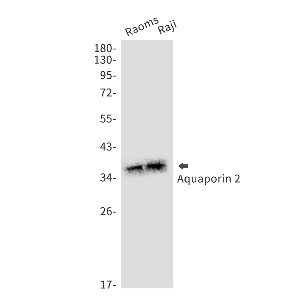 Aquaporin 2