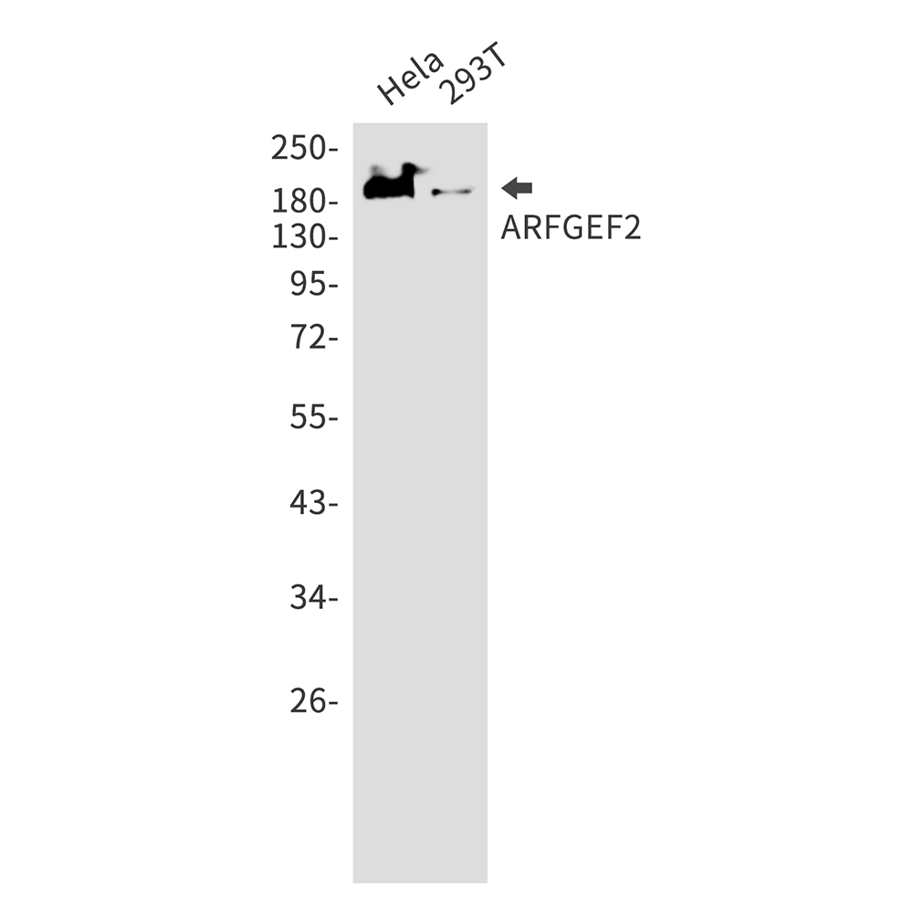 Rabbit Monoclonal Antibody to ARFGEF2