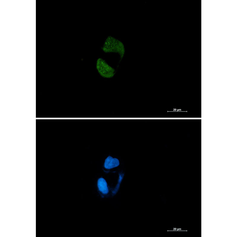 Rabbit Monoclonal Antibody to Argonaute 2