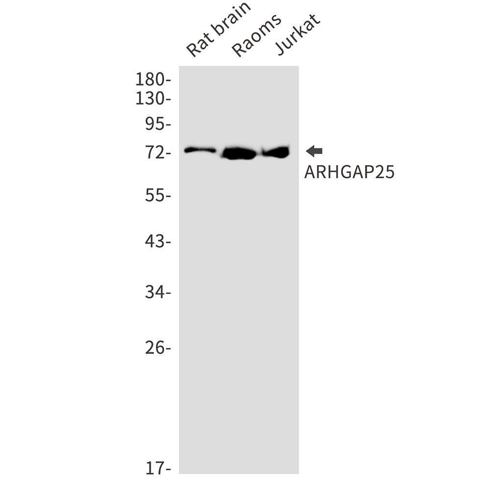 ARHGAP25
