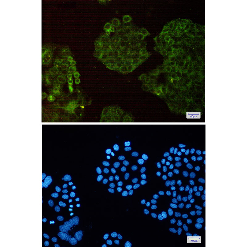 Rabbit Monoclonal Antibody to Actin Related Protein 3
