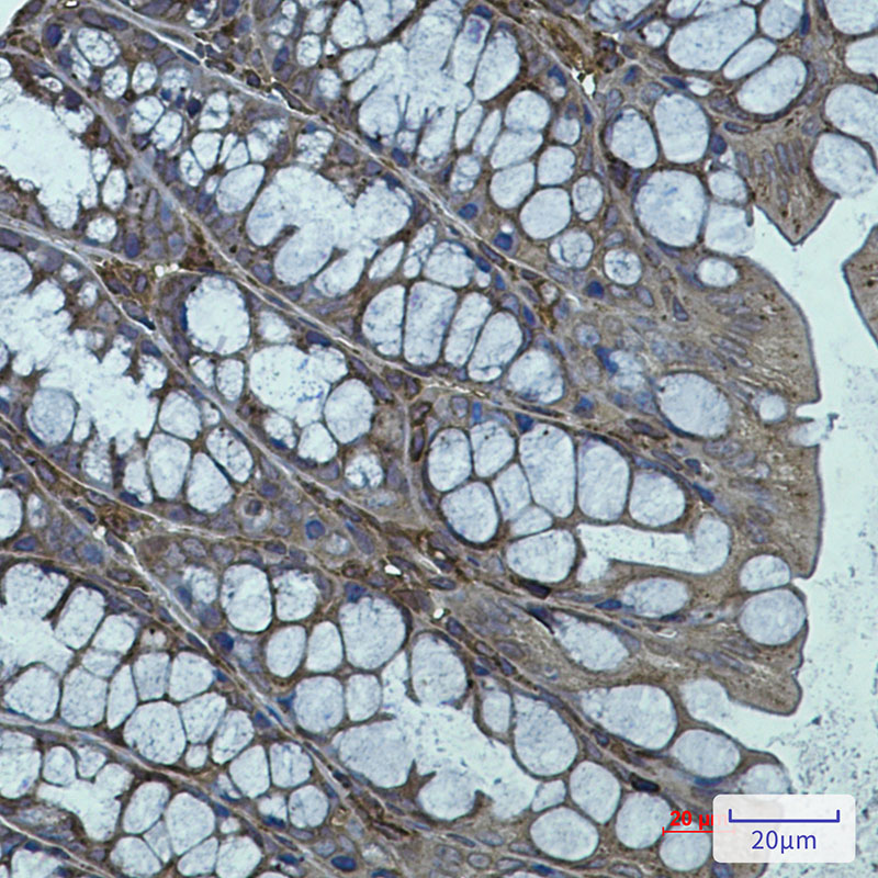 Rabbit Monoclonal Antibody to Actin Related Protein 3